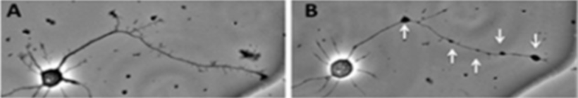Publication preview for The role of intracellular calcium in axonal injury