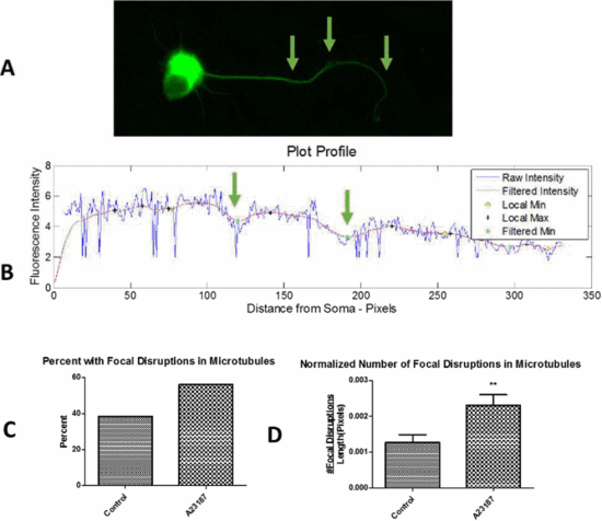 Figure from Quantifying focal disruptions in axonal microtubules