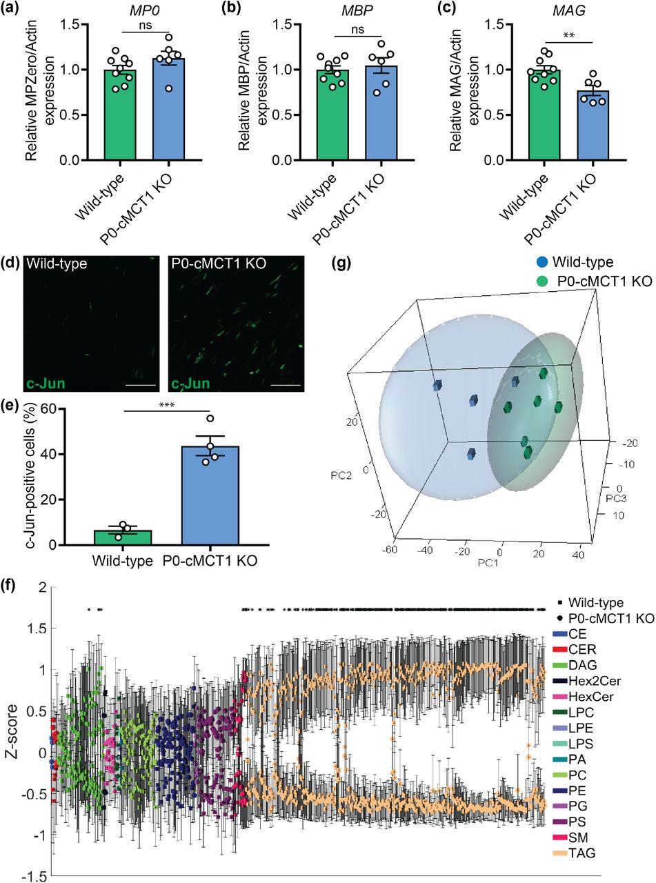 Publication preview for Monocarboxylate transporter 1 in Schwann cells is critical for maintenance of sensory nerve myelination during aging