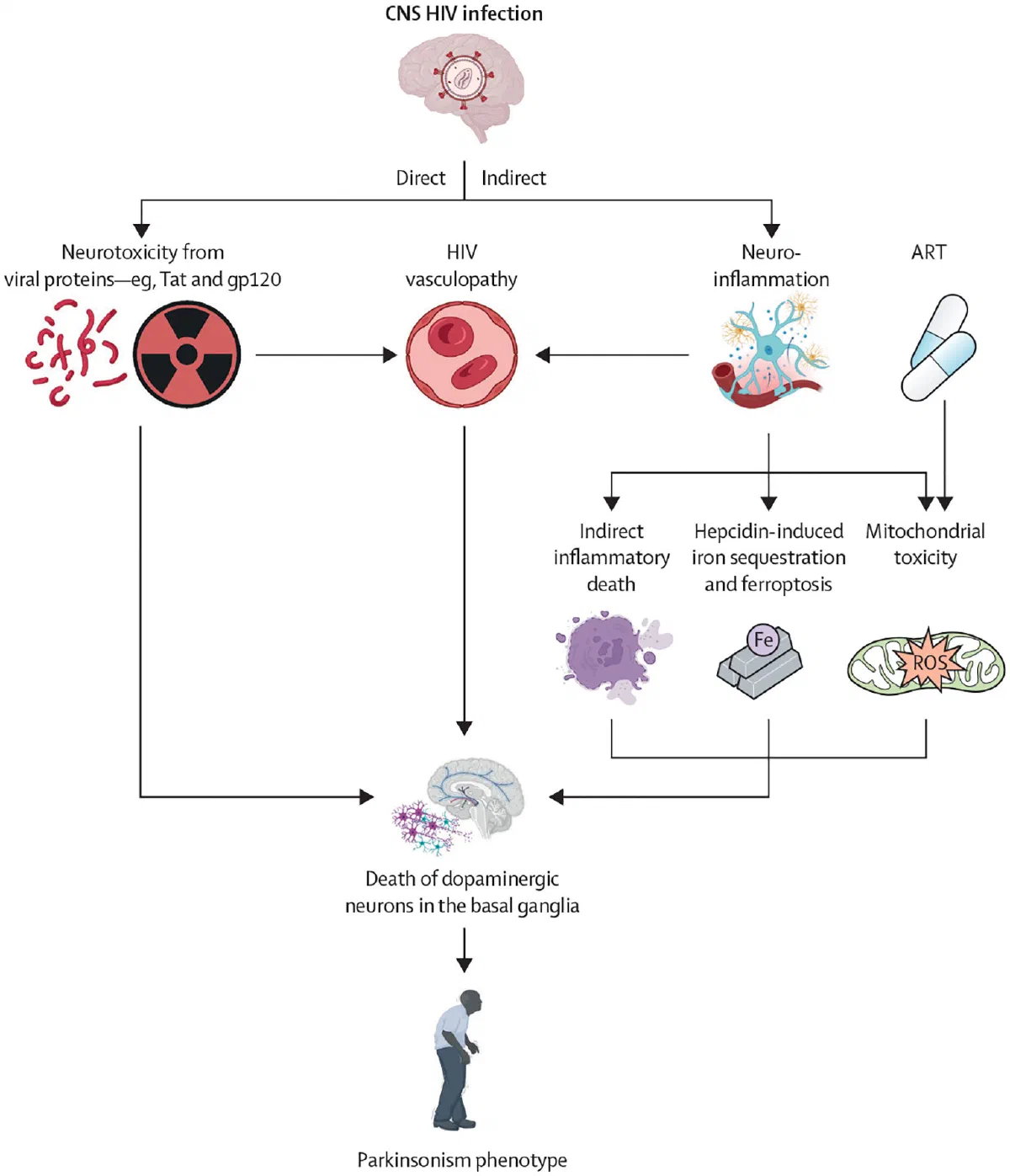 Schematic of direct and indirect pathways from CNS HIV infection to dopaminergic neuron loss and parkinsonism.